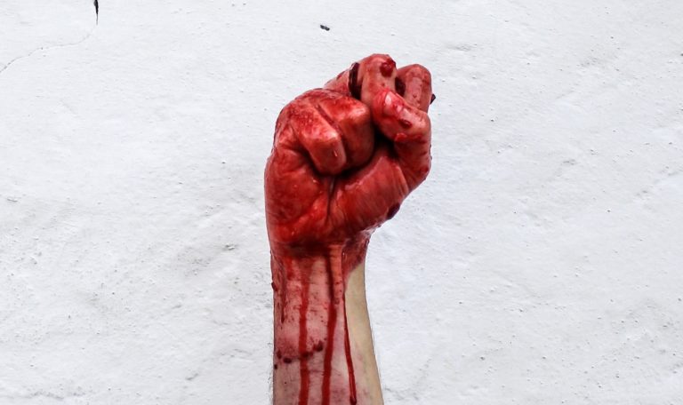 bloody hand